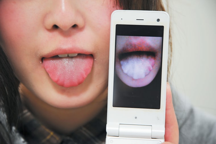 The curious case of a numb tongue